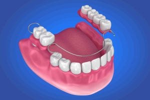 Best Dentist in Lubbock, TX Top Rated Lubbock Dentist Dentures Merrell and Nichols Dentistry dentist in Lubbock Texas Dr. P’Jay Merrell Dr. Kathleen Nichols