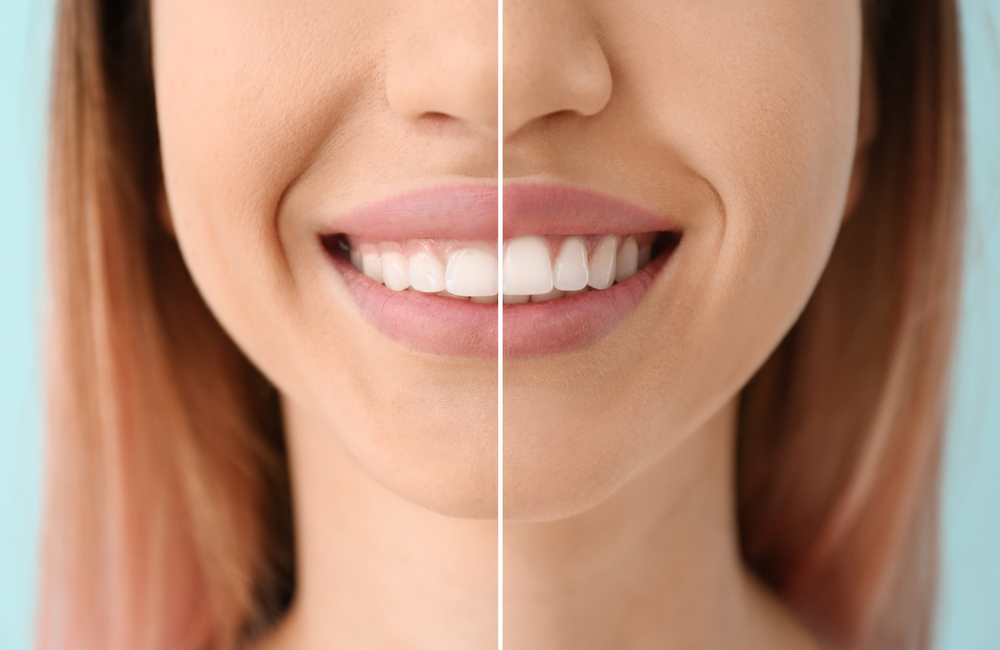  Best Dentist in Lubbock, TX Top Rated Lubbock Dentist Teeth Whitening Lubbock Dr. P’Jay Merrell Dr. Kathleen Nichols Merrell and Nichols Dentistry General, Cosmetic, Restorative, Preventative Family Dentist in Lubbock, TX 79423