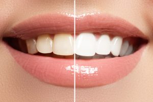 Best Dentist in Lubbock, TX Top Rated Lubbock Dentist Cosmetic Dentistry Lubbock Dr. P’Jay Merrell Dr. Kathleen Nichols Merrell and Nichols Dentistry General, Cosmetic, Restorative, Preventative Family Dentist in Lubbock, TX 79423